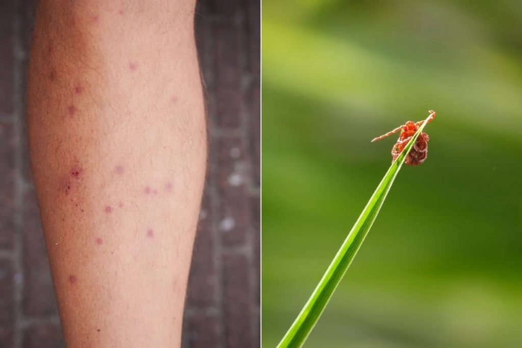 Detectar picaduras de pulgas en humanos con una imagen